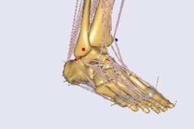 Multibody musculoskeletal modelling