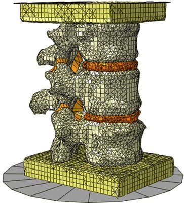 Subject-specific models from images, with direct validation process